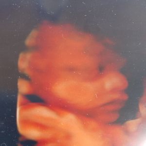 Meet your Posher, Mandiey